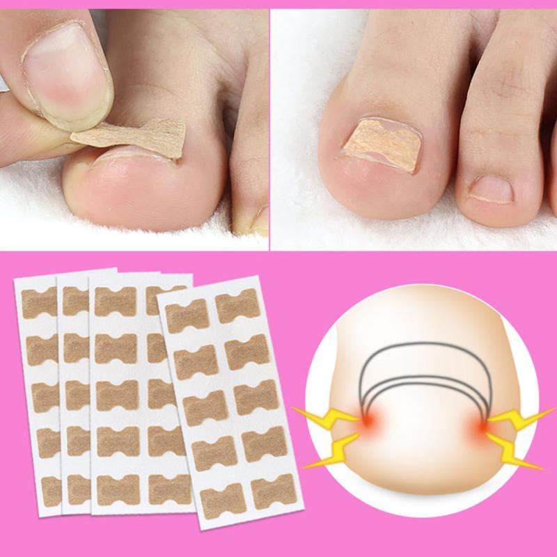 Painless Toenail Patch